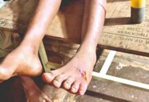 बिबट्याच्या हल्ल्यात विद्यार्थी जखमी