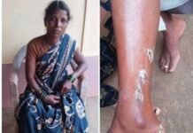 जंगलात लाकडे आणण्यासाठी गेलेल्या महिलेवर बिबट्याचा हल्ला