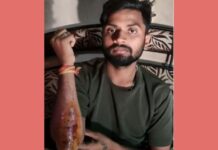 उकळत्या तेलाची कढई उडविल्याने चार ते पाच जण भाजले
