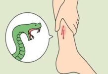 नर्सरीमध्ये काम करताना सर्पदंश; ३० वर्षीय महिलेचा मृत्यू