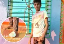 गावडे आंबेरे येथे दुचाकीस्वार युवकावर बिबट्याचा हल्ला