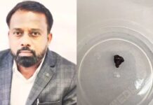 33 वर्षे शरीरात राहिला मुंबई बॉम्बस्फोटातील धातूचा तुकडा!