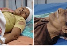 मुलाचा आई-वडिलांवर कुऱ्हाड, काचेच्या बाटलीच्या सहाय्याने जीवघेणा हल्ला